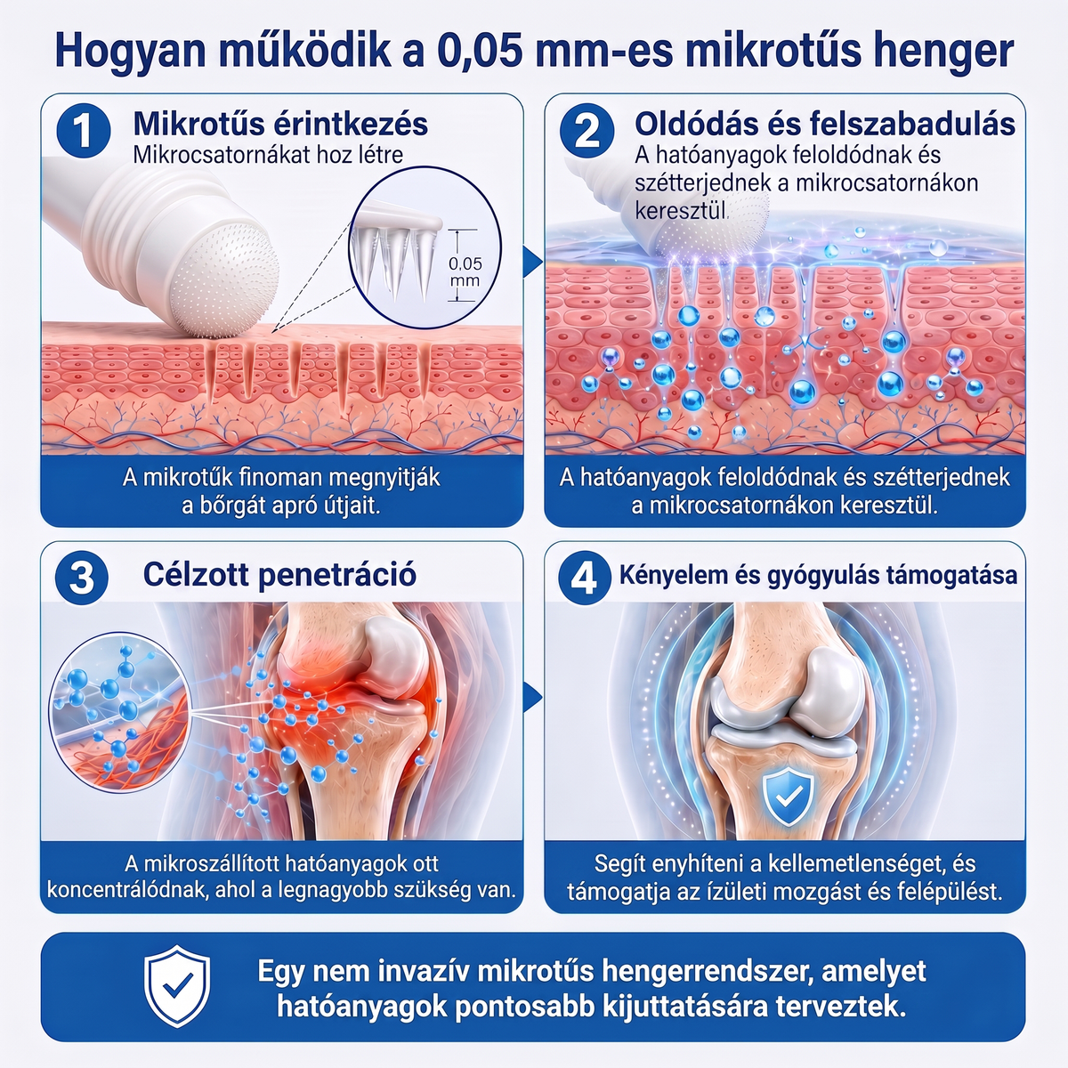 🎁 Már csak 5 darab maradt! Szerezzen most extra 50% kedvezményt, és támogassa ízületei mindennapi komfortját a Medistart® mikrotűs Roll-Onnal! 🦴✨