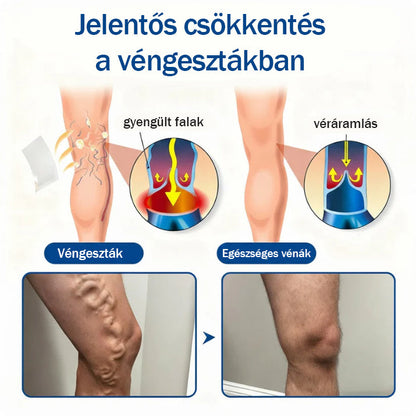 🧑‍⚕️Medistart® Visszérápoló Mikrotűs Gondozó Tapasz ⚡ Azonnali Megkönnyebbülés, Hosszú Távú Eredmények