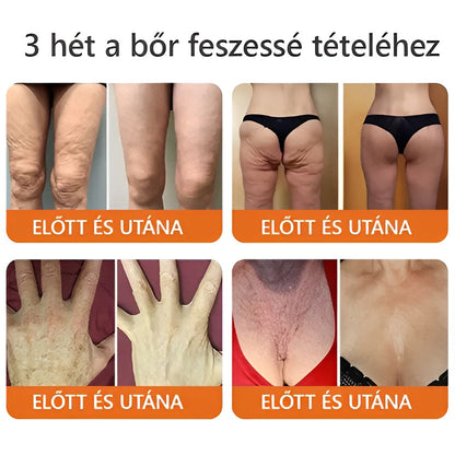 👩‍🔬🐝ZödVita® Méhméreg Bőr Helyreállító Krém 🔥 Magyar fejlesztés, magyarországi gyártás és szállítás