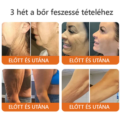 👩‍🔬🐝ZödVita® Méhméreg Bőr Helyreállító Krém 🔥 Magyar fejlesztés, magyarországi gyártás és szállítás