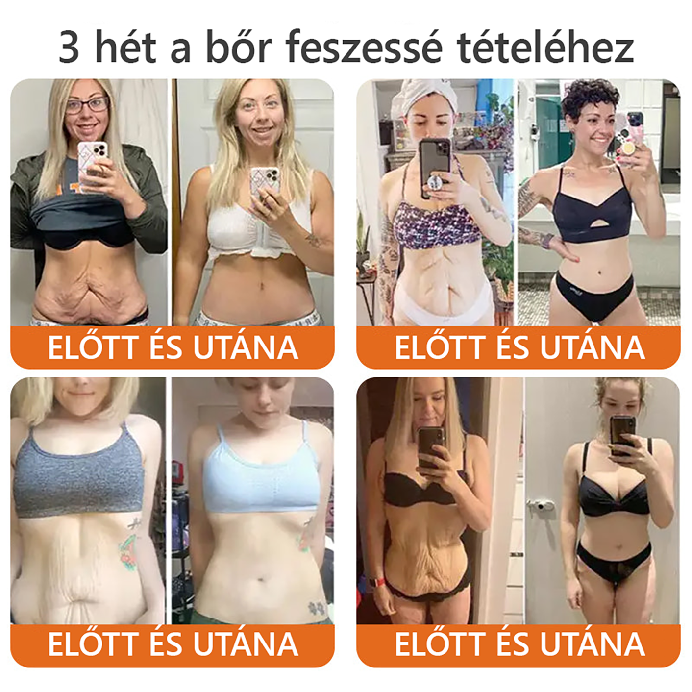👩‍🔬🐝ZödVita® Méhméreg Bőr Helyreállító Krém 🔥 Magyar fejlesztés, magyarországi gyártás és szállítás