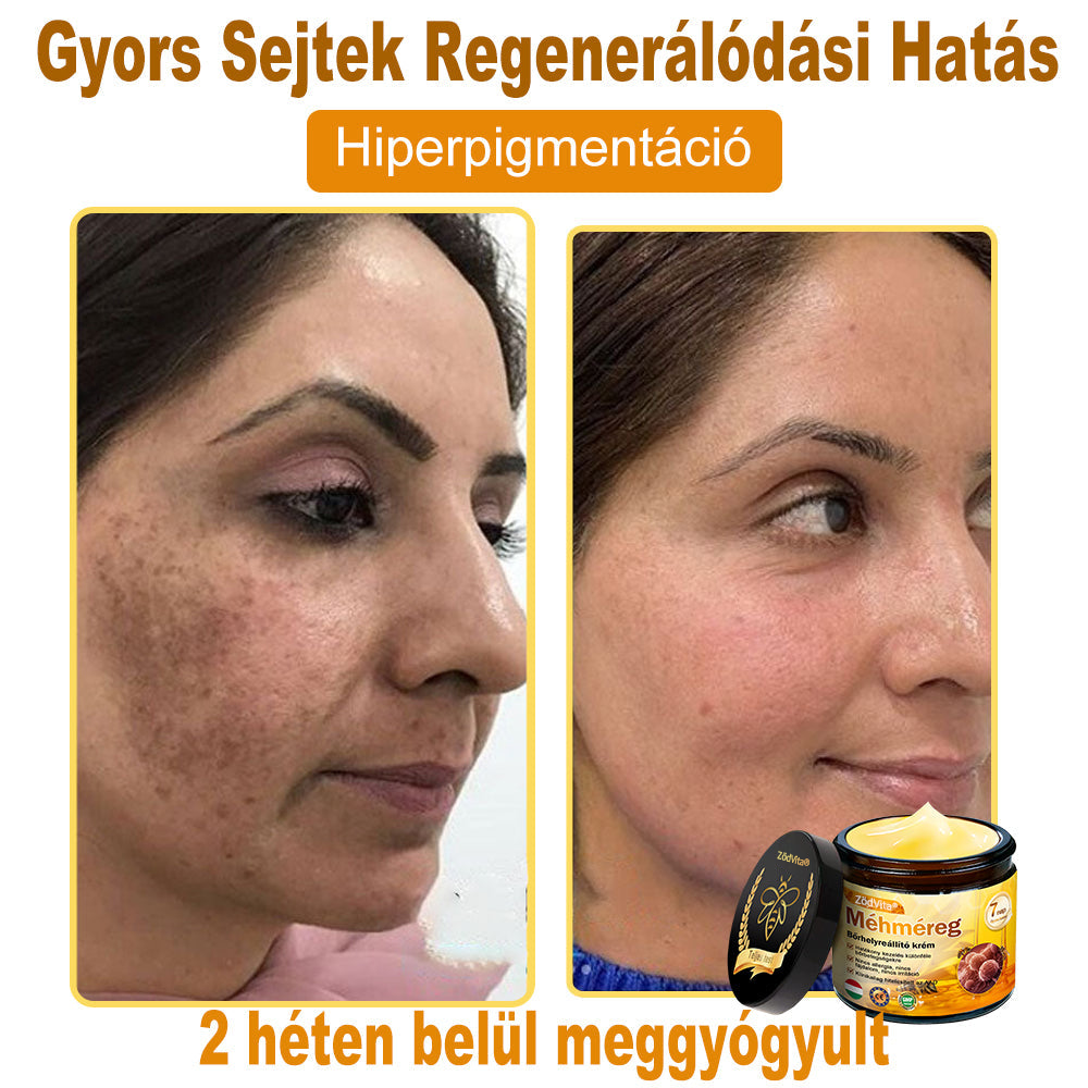 👩‍🔬🐝ZödVita® Méhméreg Bőr Helyreállító Krém 🔥 Magyar fejlesztés, magyarországi gyártás és szállítás