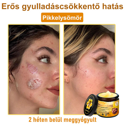✨🐝𝐏𝐮𝐫𝐚𝐂𝐮𝐫𝐞® 𝐌é𝐡𝐦é𝐫𝐞𝐠 𝐁ő𝐫 𝐇𝐞𝐥𝐲𝐫𝐞á𝐥𝐥í𝐭ó 𝐊𝐫é𝐦 (𝐂𝐄 𝐓𝐚𝐧ú𝐬í𝐭𝐯á𝐧𝐲)👍✅