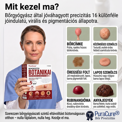 🧑‍⚕️𝐏𝐮𝐫𝐚𝐂𝐮𝐫𝐞® 𝐌𝐢𝐤𝐫𝐨-𝐭ű𝐬 𝐛𝐨𝐭𝐚𝐧𝐢𝐤𝐚𝐢 𝐛ő𝐫𝐧ö𝐯𝐞𝐝é𝐤-𝐞𝐥𝐭á𝐯𝐨𝐥í𝐭ó ✅✅𝐊é𝐬𝐳ü𝐥𝐭 𝐌𝐚𝐠𝐲𝐚𝐫𝐨𝐫𝐬𝐳á𝐠𝐨𝐧