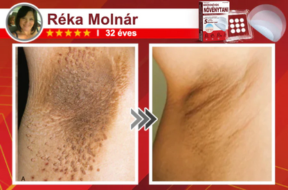 🧑‍⚕️PuraCure® Mikro-tűs botanikai bőrnövedék-eltávolító ✅✅Készült Magyarországon