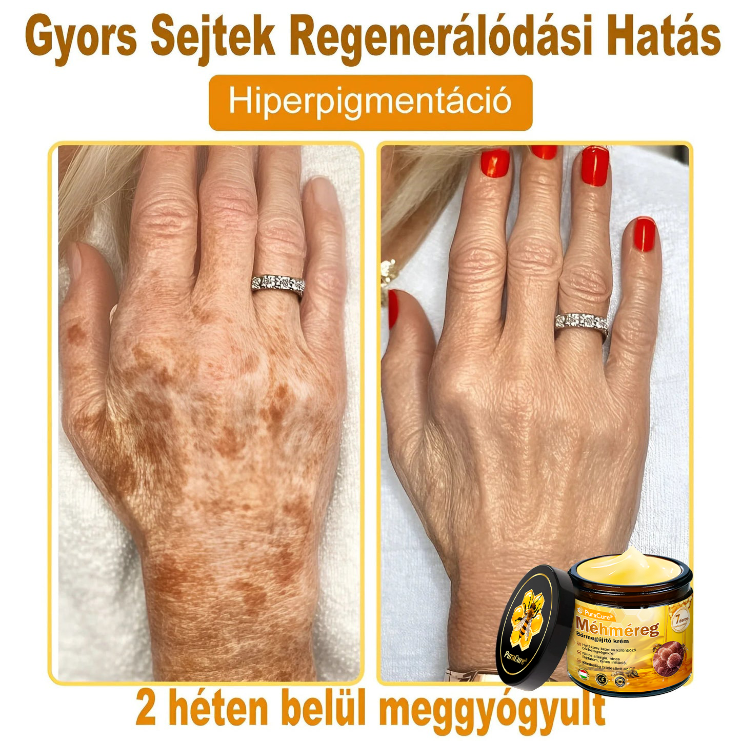 ✨🐝𝐏𝐮𝐫𝐚𝐂𝐮𝐫𝐞® 𝐌é𝐡𝐦é𝐫𝐞𝐠 𝐁ő𝐫 𝐇𝐞𝐥𝐲𝐫𝐞á𝐥𝐥í𝐭ó 𝐊𝐫é𝐦 (𝐂𝐄 𝐓𝐚𝐧ú𝐬í𝐭𝐯á𝐧𝐲)👍✅