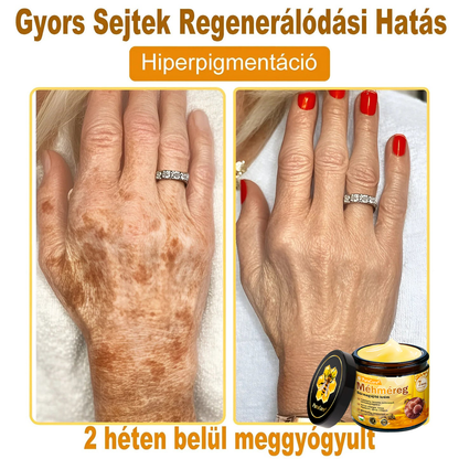 ✨🐝𝐏𝐮𝐫𝐚𝐂𝐮𝐫𝐞® 𝐌é𝐡𝐦é𝐫𝐞𝐠 𝐁ő𝐫 𝐇𝐞𝐥𝐲𝐫𝐞á𝐥𝐥í𝐭ó 𝐊𝐫é𝐦 (𝐂𝐄 𝐓𝐚𝐧ú𝐬í𝐭𝐯á𝐧𝐲)👍✅