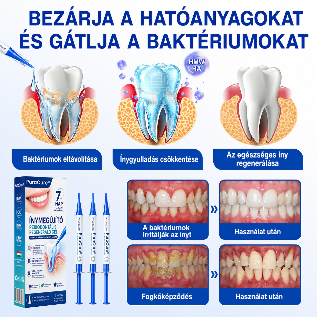 🇭🇺👨‍⚕️✅🦷 PuraCure® ÍNYMEGÚJÍTÓ – Parodontális helyreállító gél🧂