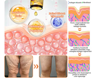 ✨🐝𝐏𝐮𝐫𝐚𝐂𝐮𝐫𝐞® 𝐌é𝐡𝐦é𝐫𝐞𝐠 𝐁ő𝐫 𝐇𝐞𝐥𝐲𝐫𝐞á𝐥𝐥í𝐭ó 𝐊𝐫é𝐦 (𝐂𝐄 𝐓𝐚𝐧ú𝐬í𝐭𝐯á𝐧𝐲)👍✅