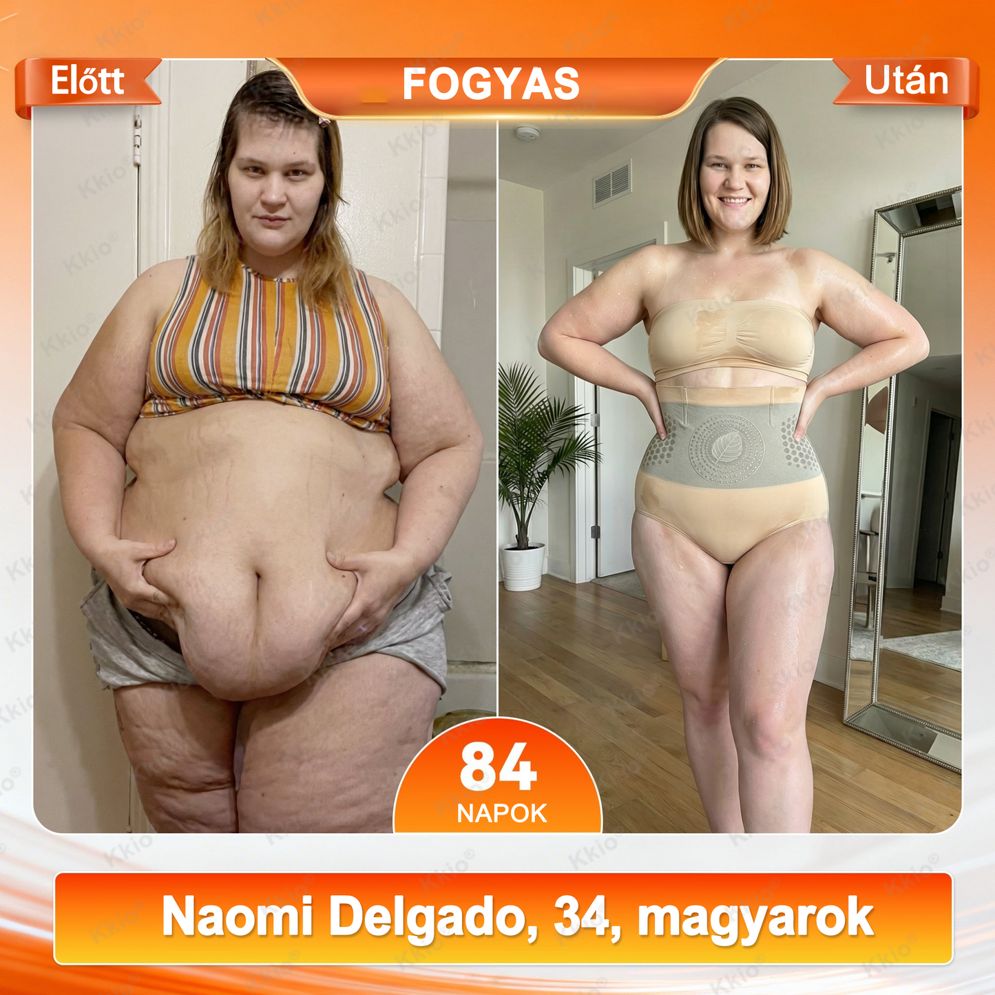 📢 𝐅𝐞𝐝𝐞𝐳𝐝 𝐟𝐞𝐥 𝐚 𝐭𝐢𝐭𝐤𝐨𝐭 – 👩 Kkio® 4 az 1-ben formáló és zsírégető rövidnadrág, mikronizált moringával és borberinnel ☘️ Kizárólag a hivatalos brand webáruházban