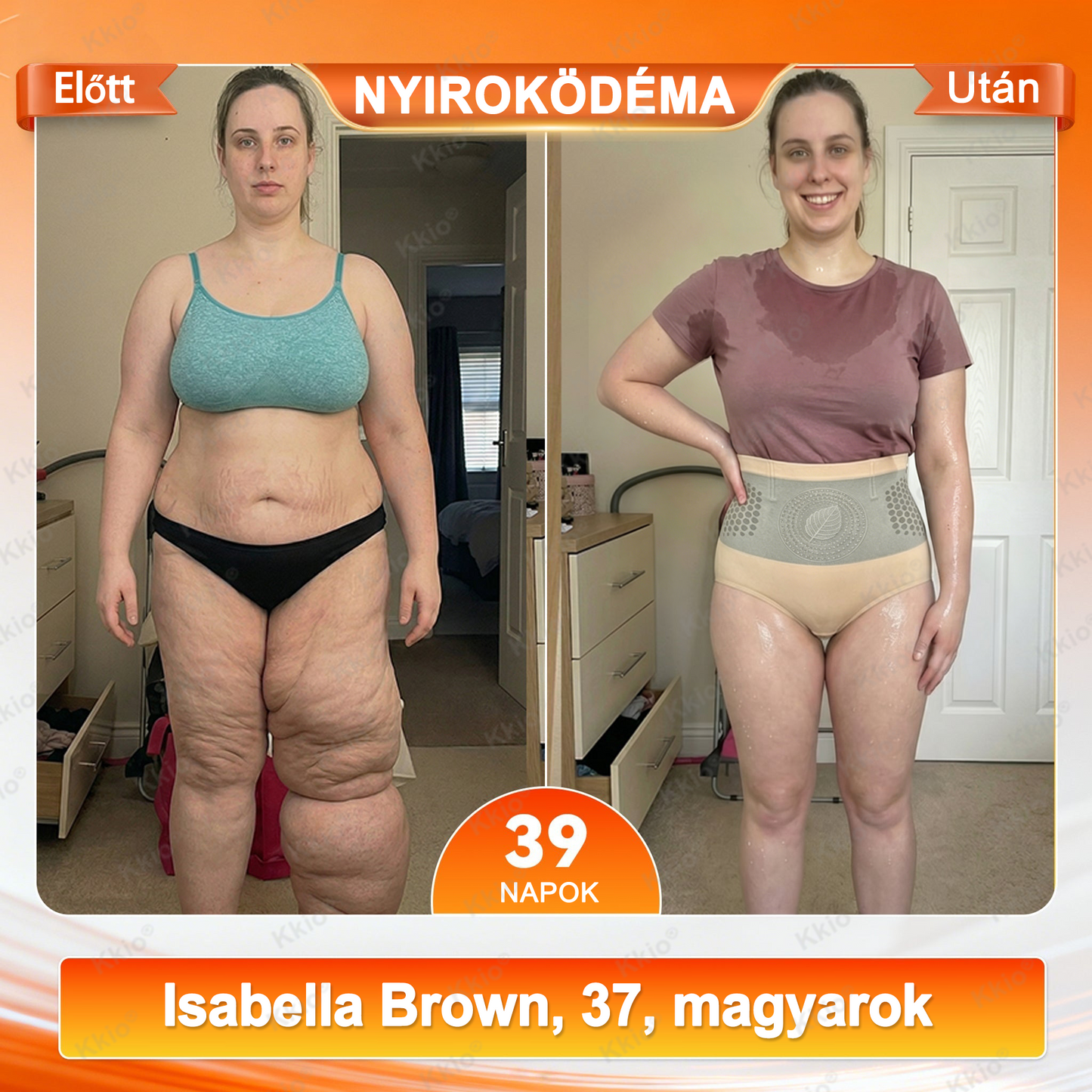 📢 𝐅𝐞𝐝𝐞𝐳𝐝 𝐟𝐞𝐥 𝐚 𝐭𝐢𝐭𝐤𝐨𝐭 – 👩 Kkio® 4 az 1-ben formáló és zsírégető rövidnadrág, mikronizált moringával és borberinnel ☘️ Kizárólag a hivatalos brand webáruházban