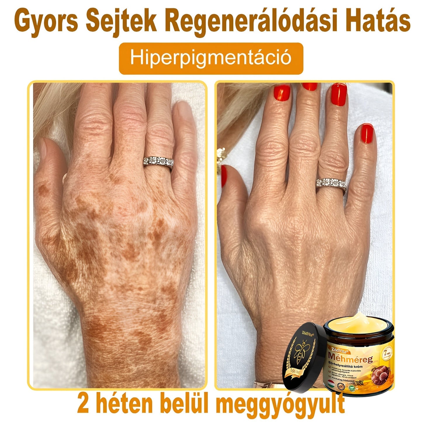 👩‍🔬🐝ZödVita® Méhméreg Bőr Helyreállító Krém 🔥 Magyar fejlesztés, magyarországi gyártás és szállítás