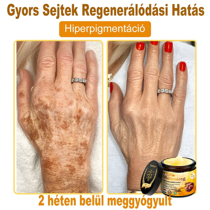 👩‍🔬🐝ZödVita® Méhméreg Bőr Helyreállító Krém 🔥 Magyar fejlesztés, magyarországi gyártás és szállítás