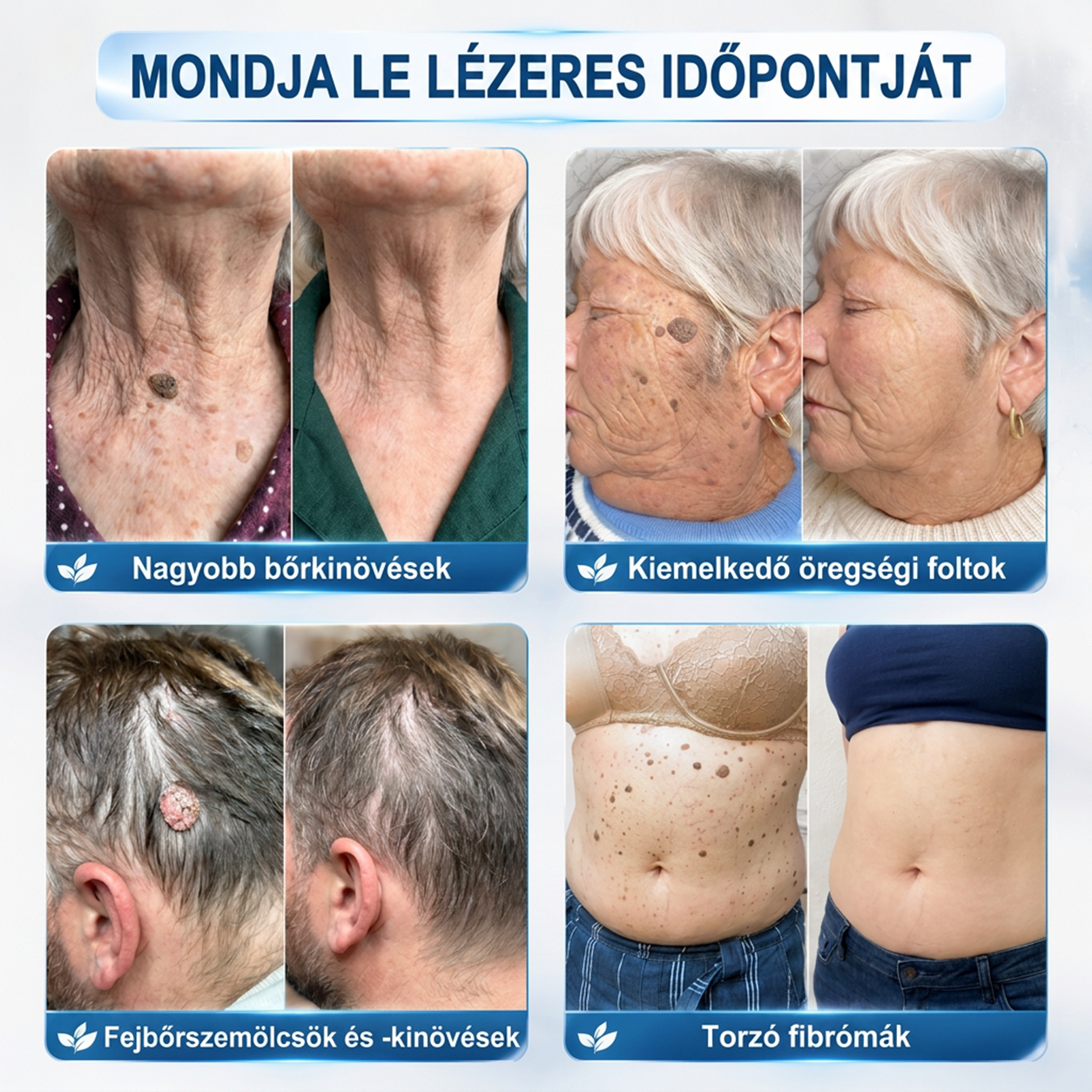 🧑‍⚕️𝐏𝐮𝐫𝐚𝐂𝐮𝐫𝐞® 𝐌𝐢𝐤𝐫𝐨-𝐭ű𝐬 𝐛𝐨𝐭𝐚𝐧𝐢𝐤𝐚𝐢 𝐛ő𝐫𝐧ö𝐯𝐞𝐝é𝐤-𝐞𝐥𝐭á𝐯𝐨𝐥í𝐭ó ✅✅𝐊é𝐬𝐳ü𝐥𝐭 𝐌𝐚𝐠𝐲𝐚𝐫𝐨𝐫𝐬𝐳á𝐠𝐨𝐧