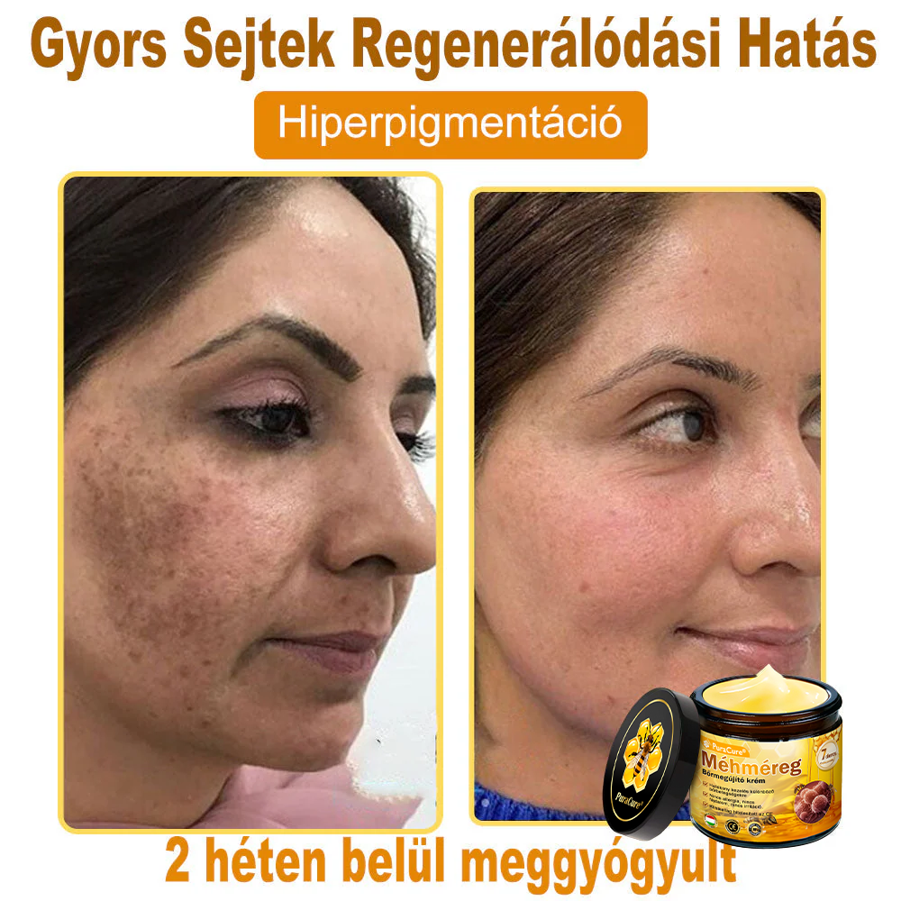 ✨🐝𝐏𝐮𝐫𝐚𝐂𝐮𝐫𝐞® 𝐌é𝐡𝐦é𝐫𝐞𝐠 𝐁ő𝐫 𝐇𝐞𝐥𝐲𝐫𝐞á𝐥𝐥í𝐭ó 𝐊𝐫é𝐦 (𝐂𝐄 𝐓𝐚𝐧ú𝐬í𝐭𝐯á𝐧𝐲)👍✅