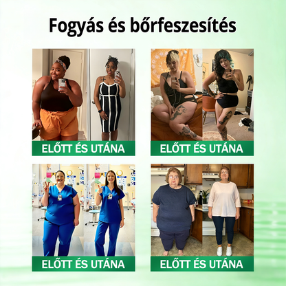 KKIO® 20 az 1-ben Glumasetide Fit & Vital mikrotűs tapasz - 7 napon belül látható változás / Alkalmas elhízás, szív- és érrendszeri egészség, cukorbetegség, alvási apnoé, bélrendszeri egészség, ízületi problémák és számos egyéb állapot esetén.