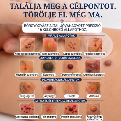 🧑‍⚕️𝐏𝐮𝐫𝐚𝐂𝐮𝐫𝐞® 𝐌𝐢𝐤𝐫𝐨-𝐭ű𝐬 𝐛𝐨𝐭𝐚𝐧𝐢𝐤𝐚𝐢 𝐛ő𝐫𝐧ö𝐯𝐞𝐝é𝐤-𝐞𝐥𝐭á𝐯𝐨𝐥í𝐭ó ✅✅𝐊é𝐬𝐳ü𝐥𝐭 𝐌𝐚𝐠𝐲𝐚𝐫𝐨𝐫𝐬𝐳á𝐠𝐨𝐧