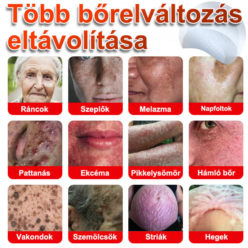 🧑‍⚕️PuraCure® Mikro-tűs botanikai bőrnövedék-eltávolító ✅✅Készült Magyarországon