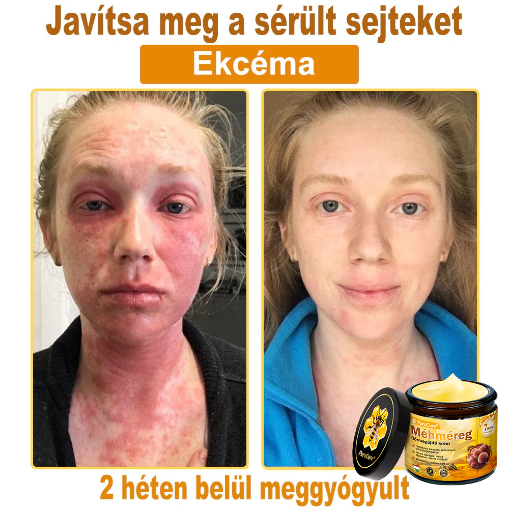 ✨🐝𝐏𝐮𝐫𝐚𝐂𝐮𝐫𝐞® 𝐌é𝐡𝐦é𝐫𝐞𝐠 𝐁ő𝐫 𝐇𝐞𝐥𝐲𝐫𝐞á𝐥𝐥í𝐭ó 𝐊𝐫é𝐦 (𝐂𝐄 𝐓𝐚𝐧ú𝐬í𝐭𝐯á𝐧𝐲)👍✅
