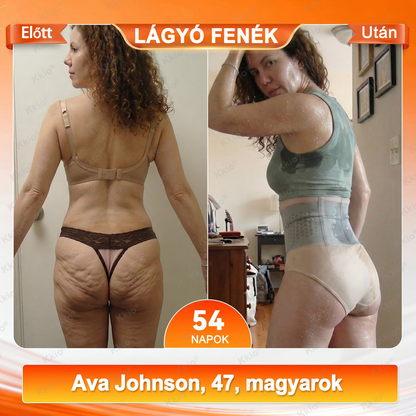 📢 𝐅𝐞𝐝𝐞𝐳𝐝 𝐟𝐞𝐥 𝐚 𝐭𝐢𝐭𝐤𝐨𝐭 – 👩 Kkio® 4 az 1-ben formáló és zsírégető rövidnadrág, mikronizált moringával és borberinnel ☘️ Kizárólag a hivatalos brand webáruházban