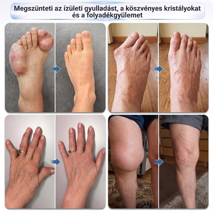 🎁 Már csak 5 darab maradt! Szerezzen most extra 50% kedvezményt, és támogassa ízületei mindennapi komfortját a Medistart® mikrotűs Roll-Onnal! 🦴✨