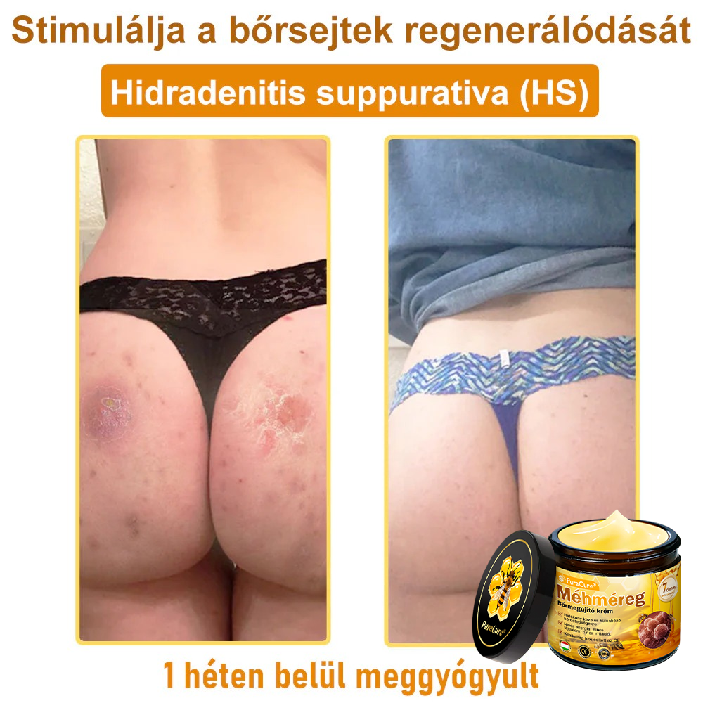 ✨🐝𝐏𝐮𝐫𝐚𝐂𝐮𝐫𝐞® 𝐌é𝐡𝐦é𝐫𝐞𝐠 𝐁ő𝐫 𝐇𝐞𝐥𝐲𝐫𝐞á𝐥𝐥í𝐭ó 𝐊𝐫é𝐦 (𝐂𝐄 𝐓𝐚𝐧ú𝐬í𝐭𝐯á𝐧𝐲)👍✅