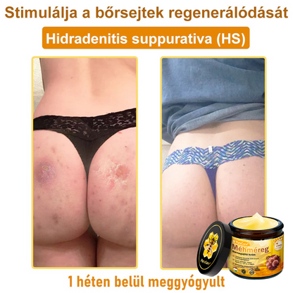 ✨🐝𝐏𝐮𝐫𝐚𝐂𝐮𝐫𝐞® 𝐌é𝐡𝐦é𝐫𝐞𝐠 𝐁ő𝐫 𝐇𝐞𝐥𝐲𝐫𝐞á𝐥𝐥í𝐭ó 𝐊𝐫é𝐦 (𝐂𝐄 𝐓𝐚𝐧ú𝐬í𝐭𝐯á𝐧𝐲)👍✅