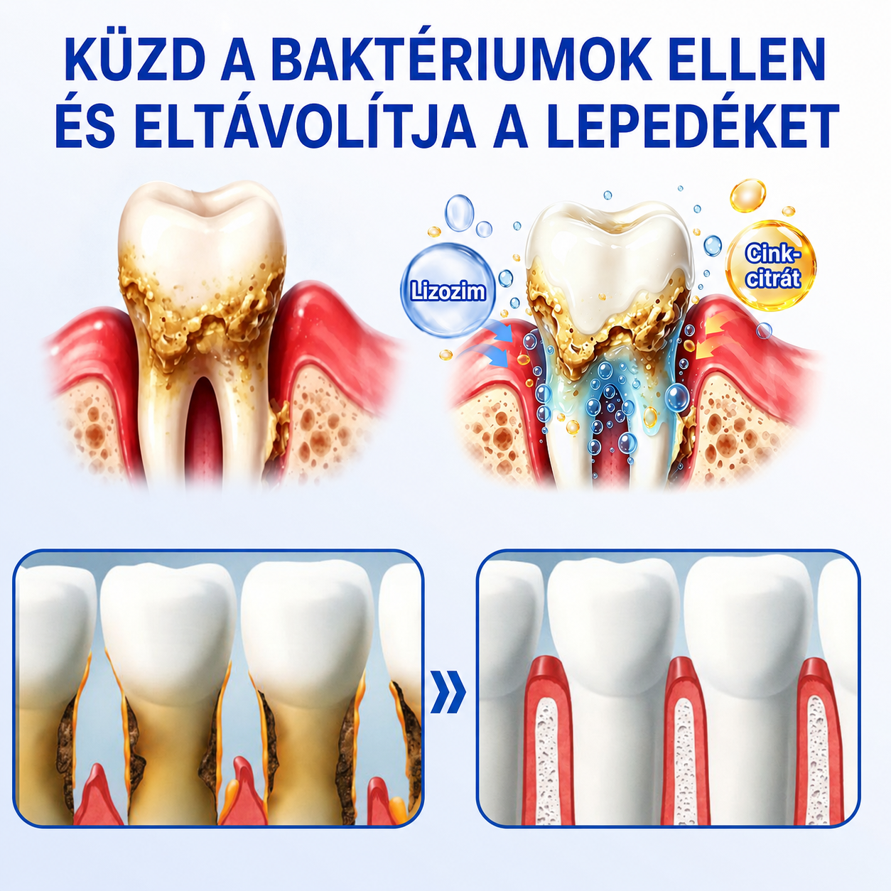 🇭🇺👨‍⚕️✅🦷 PuraCure® ÍNYMEGÚJÍTÓ – Parodontális helyreállító gél🧂