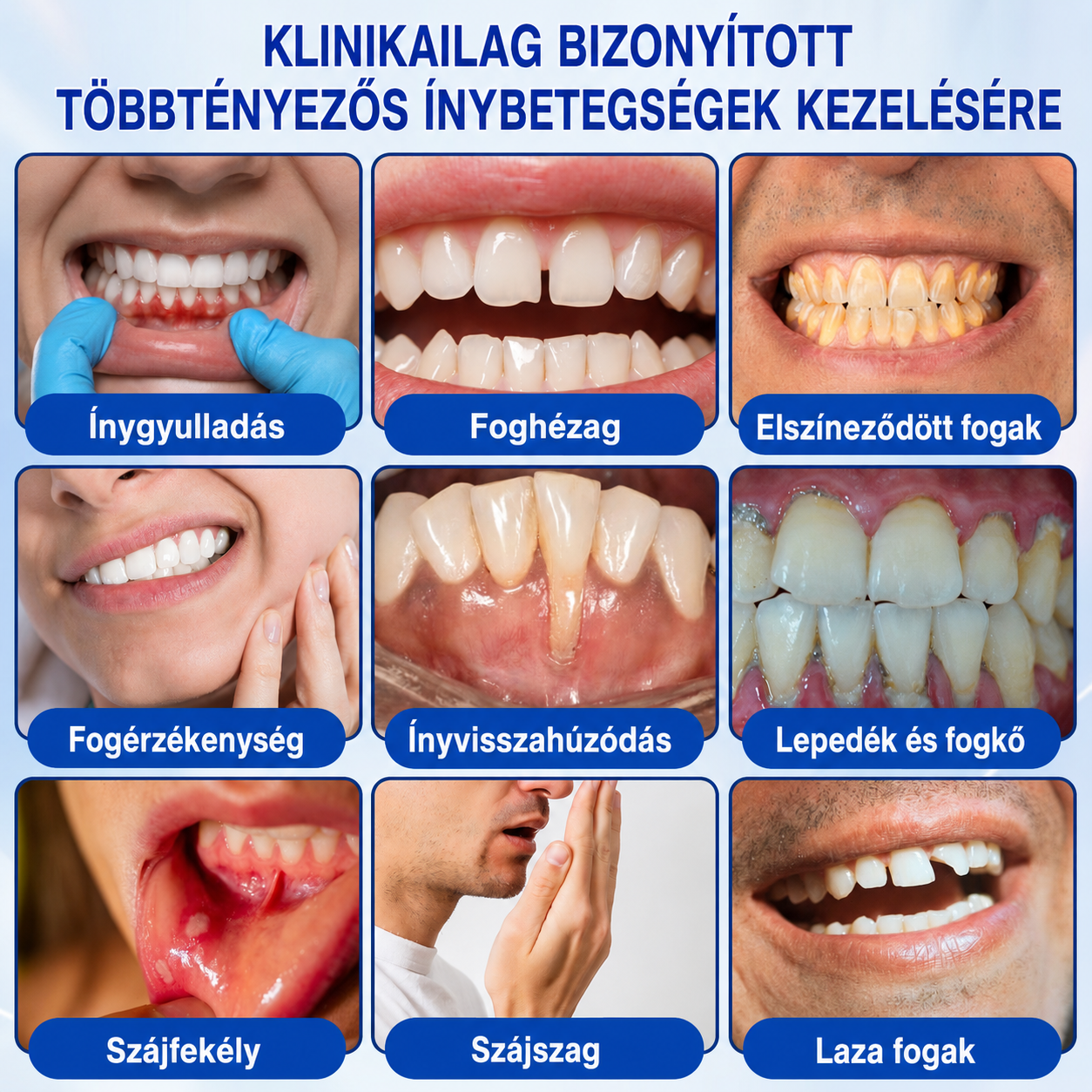 🇭🇺👨‍⚕️✅🦷 PuraCure® ÍNYMEGÚJÍTÓ – Parodontális helyreállító gél🧂
